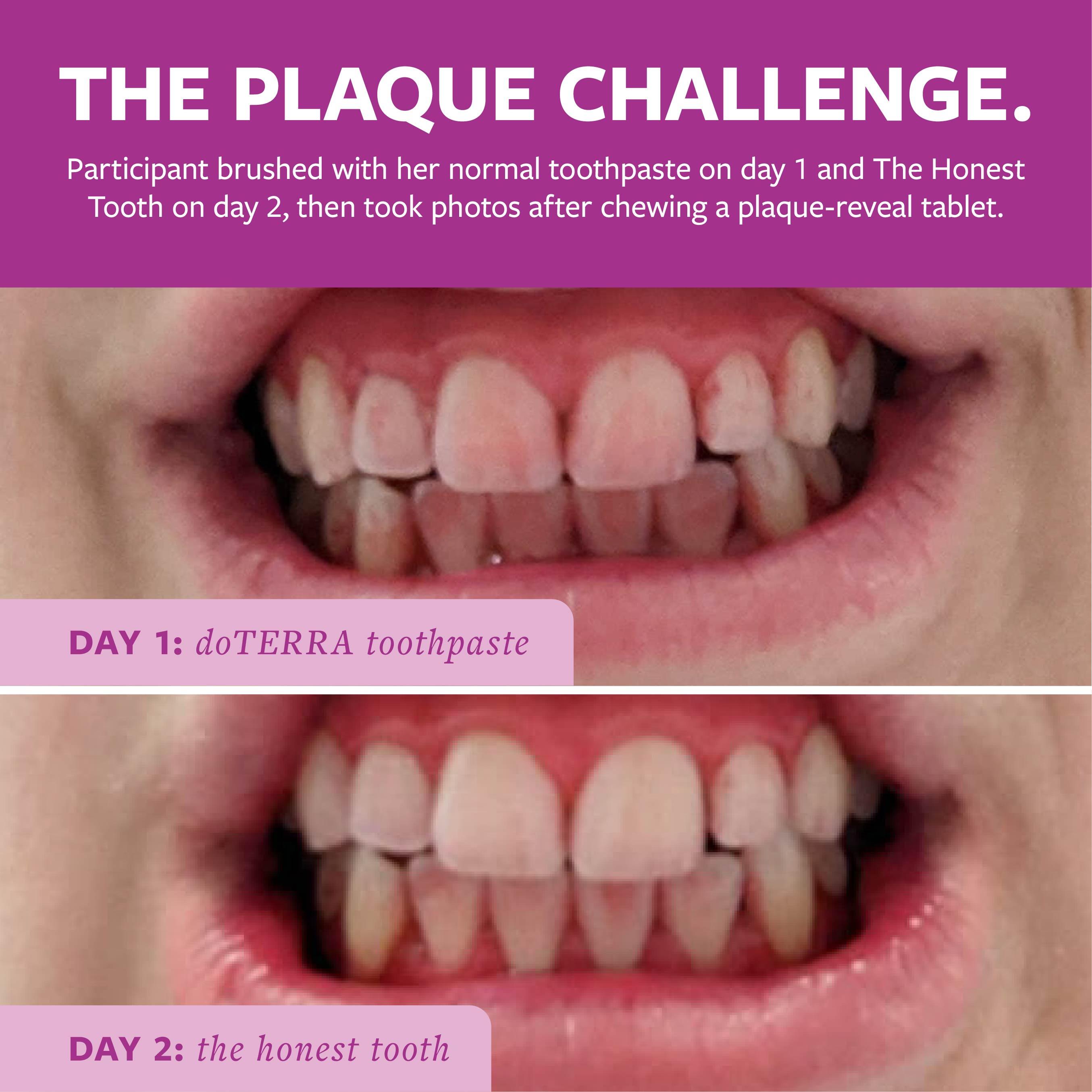 The Honest Tooth — Tooth Powder, Hard Plaque Remover