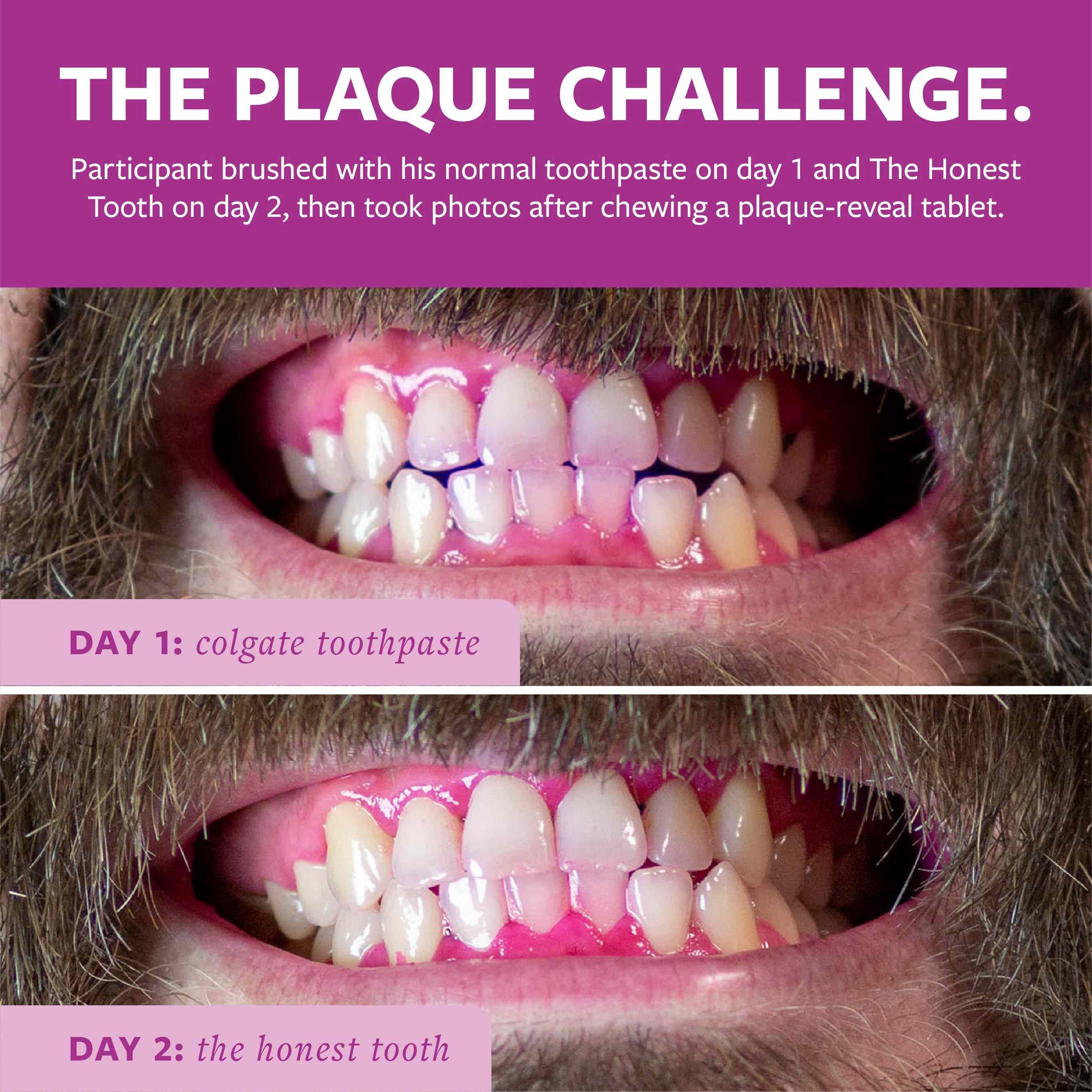 The Honest Tooth — Tooth Powder, Hard Plaque Remover